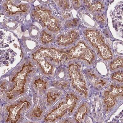 Immunohistochemistry: ARL5C Antibody [NBP2-49623]