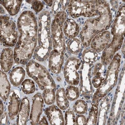 Immunohistochemistry-Paraffin: ARL6 Antibody [NBP1-88689]