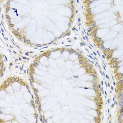 Immunohistochemistry-Paraffin: ARL6 Antibody - BSA Free [NBP2-92831]