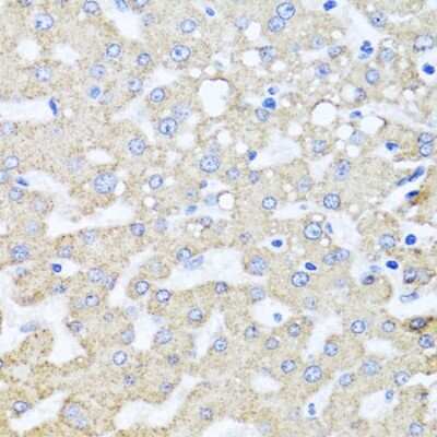 Immunohistochemistry-Paraffin: ARL6 Antibody - BSA Free [NBP2-92831]