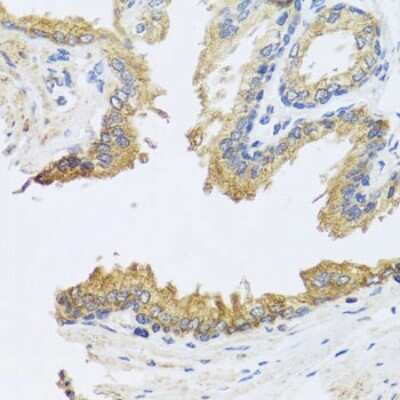 Immunohistochemistry-Paraffin: ARL6 Antibody - BSA Free [NBP2-92831]
