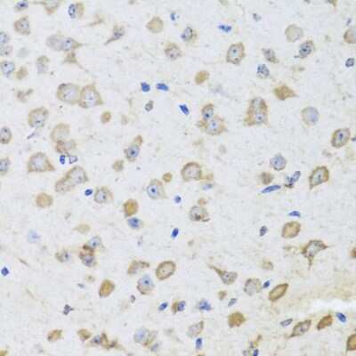 Immunohistochemistry-Paraffin: ARL6 Antibody - BSA Free [NBP2-92831]