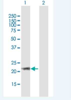 Western Blot: ARL6 Antibody [H00084100-B01P-50ug]