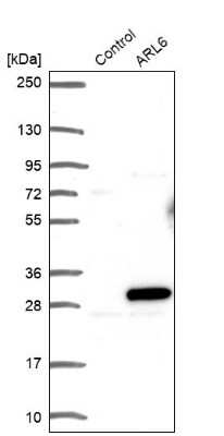 Western Blot: ARL6 Antibody [NBP1-88689]