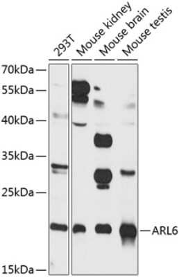 Western Blot: ARL6 AntibodyBSA Free [NBP2-92831]