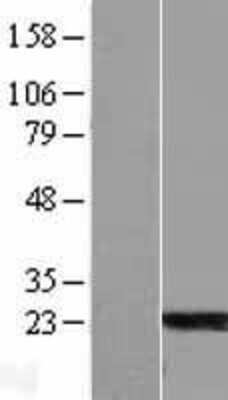 Western Blot: ARL6 Overexpression Lysate [NBL1-07699]