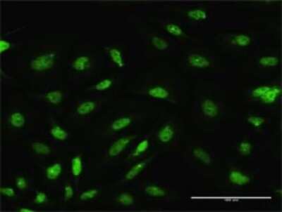 Immunocytochemistry/ Immunofluorescence: ARL6IP4 Antibody [H00051329-D01P]