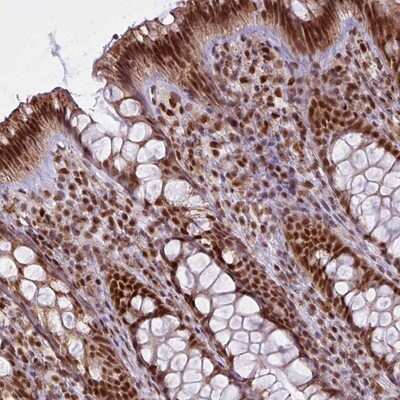 Immunohistochemistry-Paraffin: ARL6IP4 Antibody [NBP2-14313]