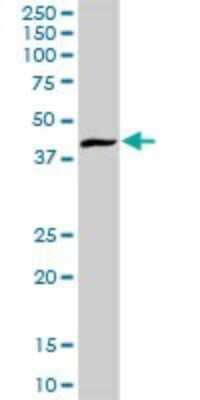 Western Blot: ARL6IP4 Antibody [H00051329-D01P]