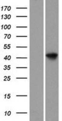 Western Blot: ARL6IP4 Overexpression Lysate [NBP2-07011]