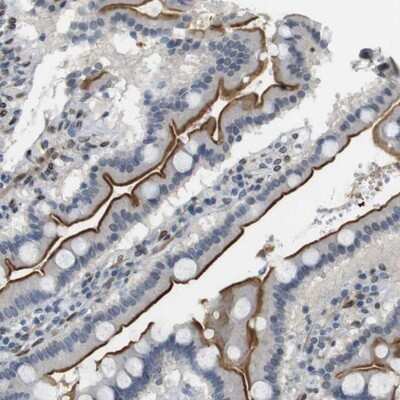 Immunohistochemistry-Paraffin: ARL6IP6 Antibody [NBP1-81109]