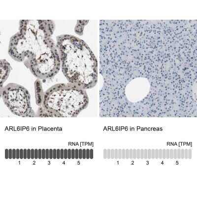 Immunohistochemistry-Paraffin: ARL6IP6 Antibody [NBP1-81109]