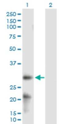 Western Blot: ARL6IP6 Antibody [H00151188-B02P]