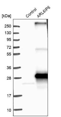 Western Blot: ARL6IP6 Antibody [NBP1-81109]