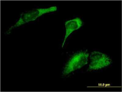 Immunocytochemistry/ Immunofluorescence: ARL8A Antibody (3H4) [H00127829-M02]