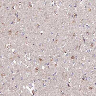 Immunohistochemistry: ARL8A Antibody [NBP2-14315]