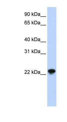 Western Blot: ARL8A Antibody [NBP1-58860]