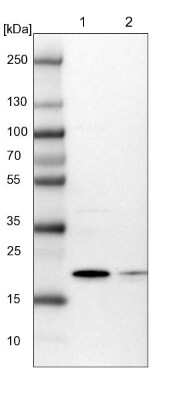 Western Blot: ARL8A Antibody [NBP2-14314]