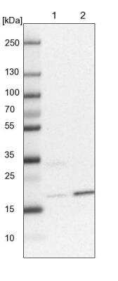 Western Blot: ARL8A Antibody [NBP2-14316]