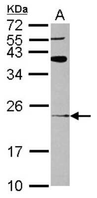 Western Blot: ARL8A Antibody [NBP2-15466]