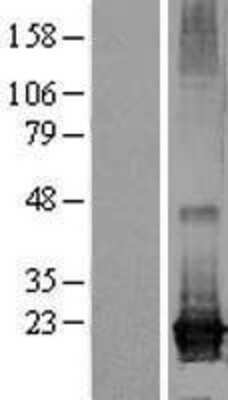 Western Blot: ARL8A Overexpression Lysate [NBL1-07703]