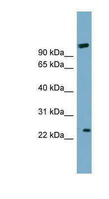 Western Blot: ARL8B Antibody [NBP1-56544]