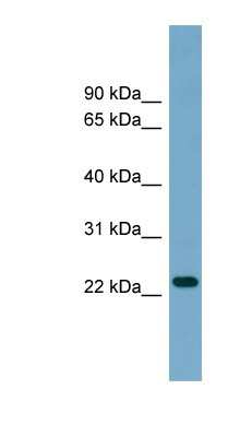 Western Blot: ARL8B Antibody [NBP1-56577]