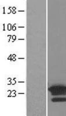 Western Blot: ARL8B Overexpression Lysate [NBL1-07704]