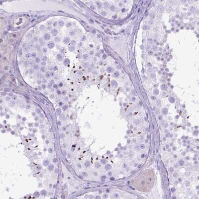 Immunohistochemistry: ARL9 Antibody [NBP2-49679]