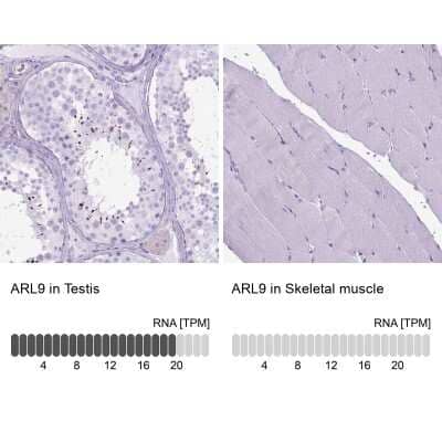 Immunohistochemistry-Paraffin: ARL9 Antibody [NBP2-49679]