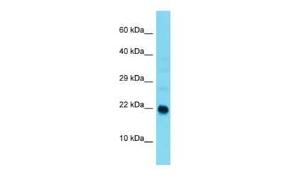 Western Blot: ARL9 Antibody [NBP2-84459]