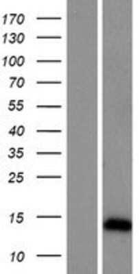 Western Blot: ARL9 Overexpression Lysate [NBP2-04520]