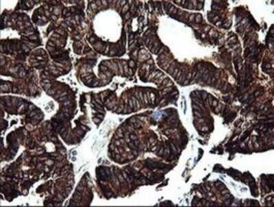 Immunohistochemistry: ARMC1 Antibody (OTI1D10) - Azide and BSA Free [NBP2-71989]