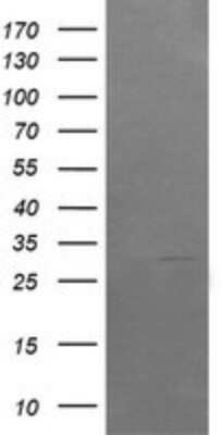 Western Blot: ARMC1 Antibody (OTI1D10)Azide and BSA Free [NBP2-71989]