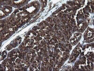 Immunohistochemistry: ARMC1 Antibody (OTI1D10) [NBP2-46543]