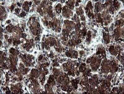 Immunohistochemistry: ARMC1 Antibody (OTI1D10) [NBP2-46543]