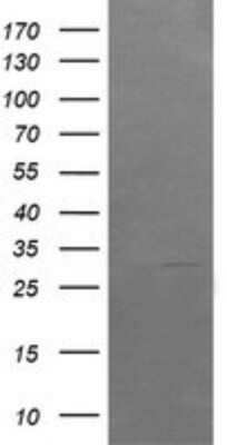 Western Blot: ARMC1 Antibody (OTI1D10) [NBP2-46543]