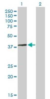 Western Blot: ARMC1 Antibody [H00055156-B01P]