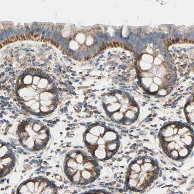 Immunohistochemistry-Paraffin: ARMC10 Antibody [NBP1-81127]