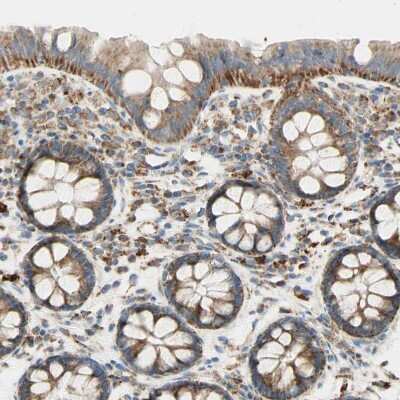 Immunohistochemistry-Paraffin: ARMC10 Antibody [NBP1-81128]