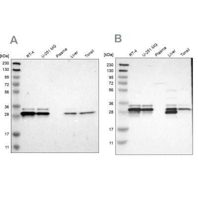 Western Blot: ARMC10 Antibody [NBP1-81128]