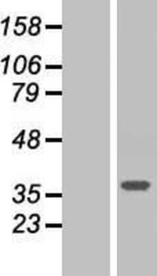 Western Blot: ARMC10 Overexpression Lysate [NBP2-06108]