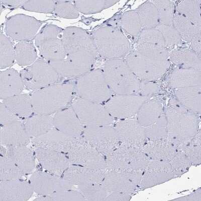 Immunohistochemistry-Paraffin: ARMC12 Antibody [NBP3-17133]
