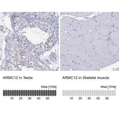 Immunohistochemistry-Paraffin: ARMC12 Antibody [NBP3-17133]