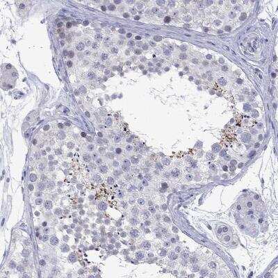Immunohistochemistry-Paraffin: ARMC12 Antibody [NBP3-17133]