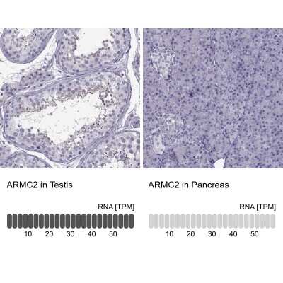 Immunohistochemistry-Paraffin: ARMC2 Antibody [NBP1-88730]