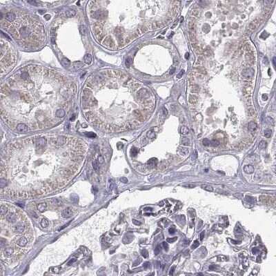 Immunohistochemistry-Paraffin: ARMC3 Antibody [NBP1-85394]