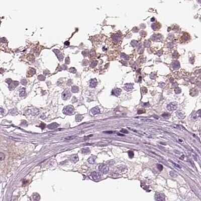 Immunohistochemistry-Paraffin: ARMC3 Antibody [NBP2-32703]