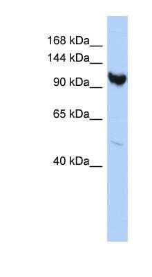 Western Blot: ARMC3 Antibody [NBP1-70412]