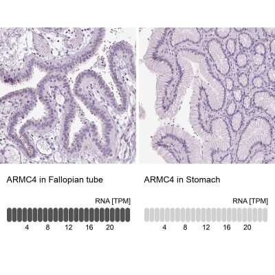 Immunohistochemistry-Paraffin: ARMC4 Antibody [NBP1-84175]